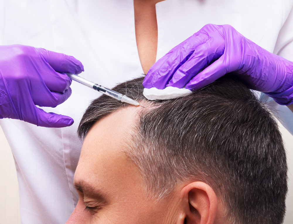Tratamiento de medicina capilar en clínica de medicina estética